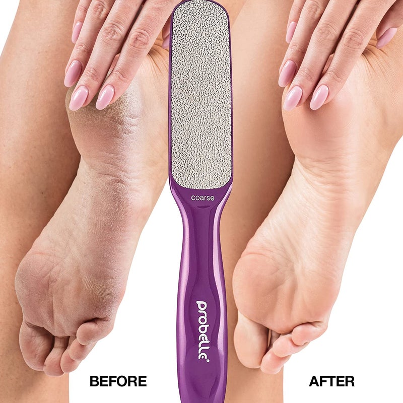 Probelle Double Sided Multidirectional Nickel Foot File Callus Remover - Immediately Reduces calluses and Corns to Powder for Instant Results  Safe Tool (Purple) - Image 4